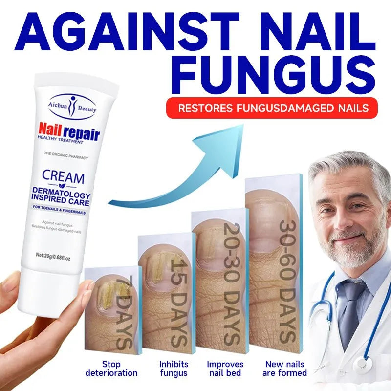 CREMA P/ HONGOS DE UÑAS DE PIES Y MANOS