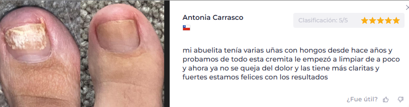 CREMA P/ HONGOS DE UÑAS DE PIES Y MANOS